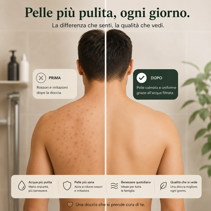 AquaSerena™ – Soffione Filtrante per una Doccia più Delicata